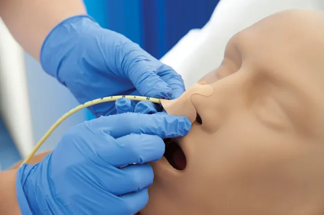 Ryles Tube Insertion