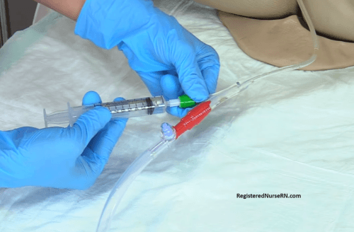Urinary Cathetheter Removal